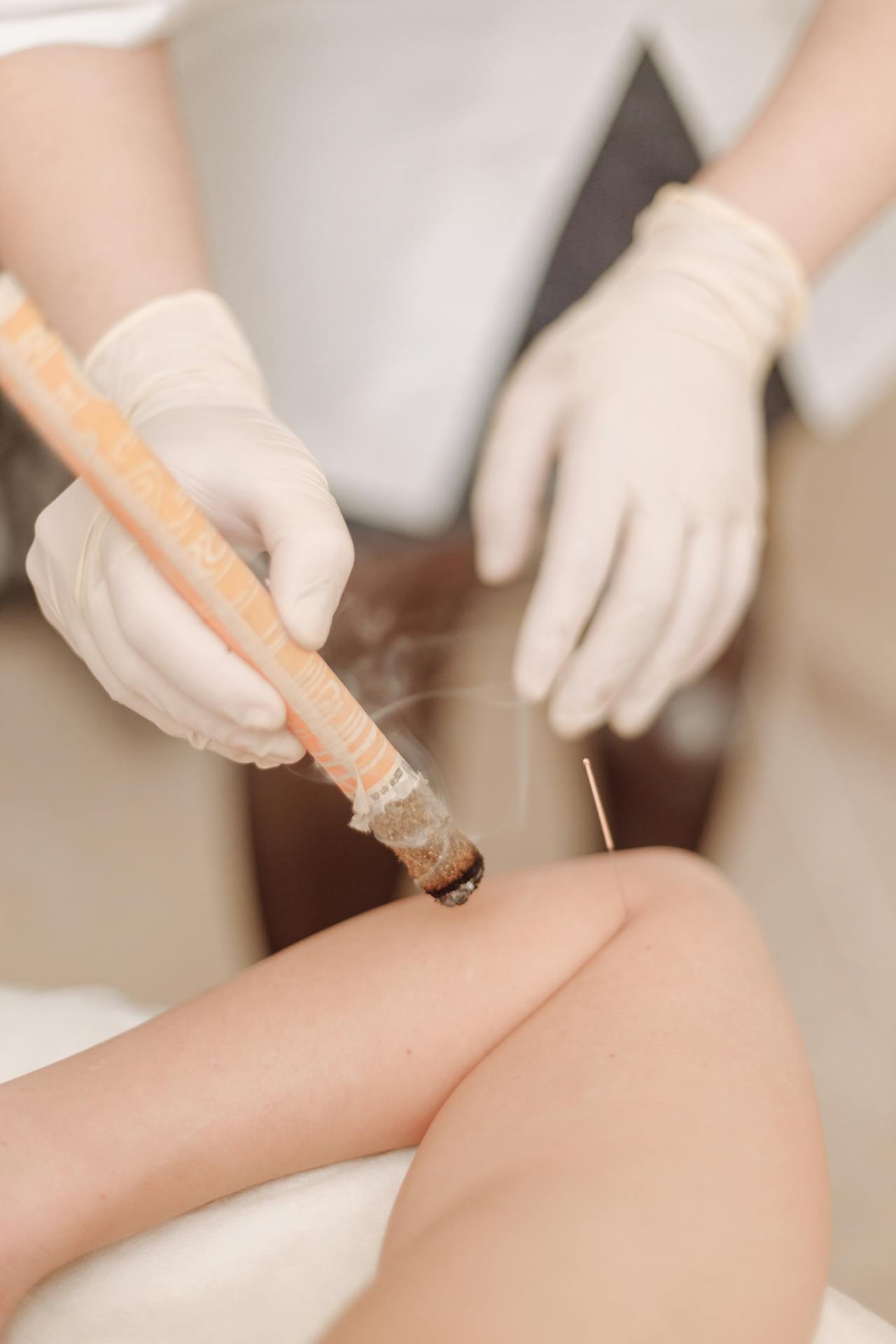 Anwendung einer Wärmetherapie namens Moxibustion, Person hält eine Art Zigarrenstift und bearbeitet Rücken eines Patienten